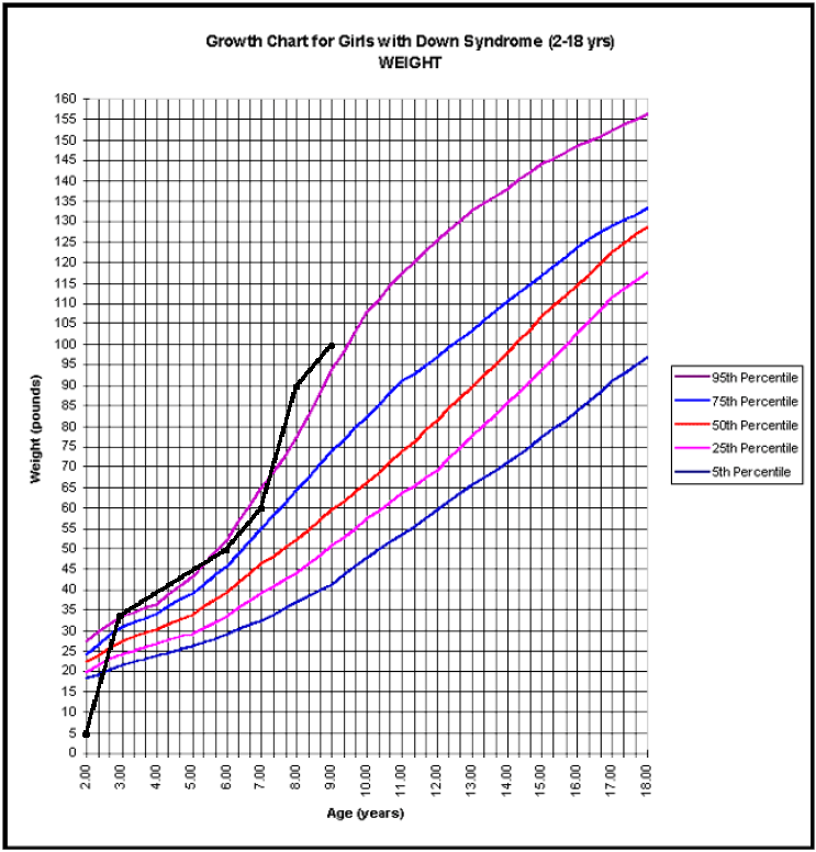 Down Syndrome Growth Chart